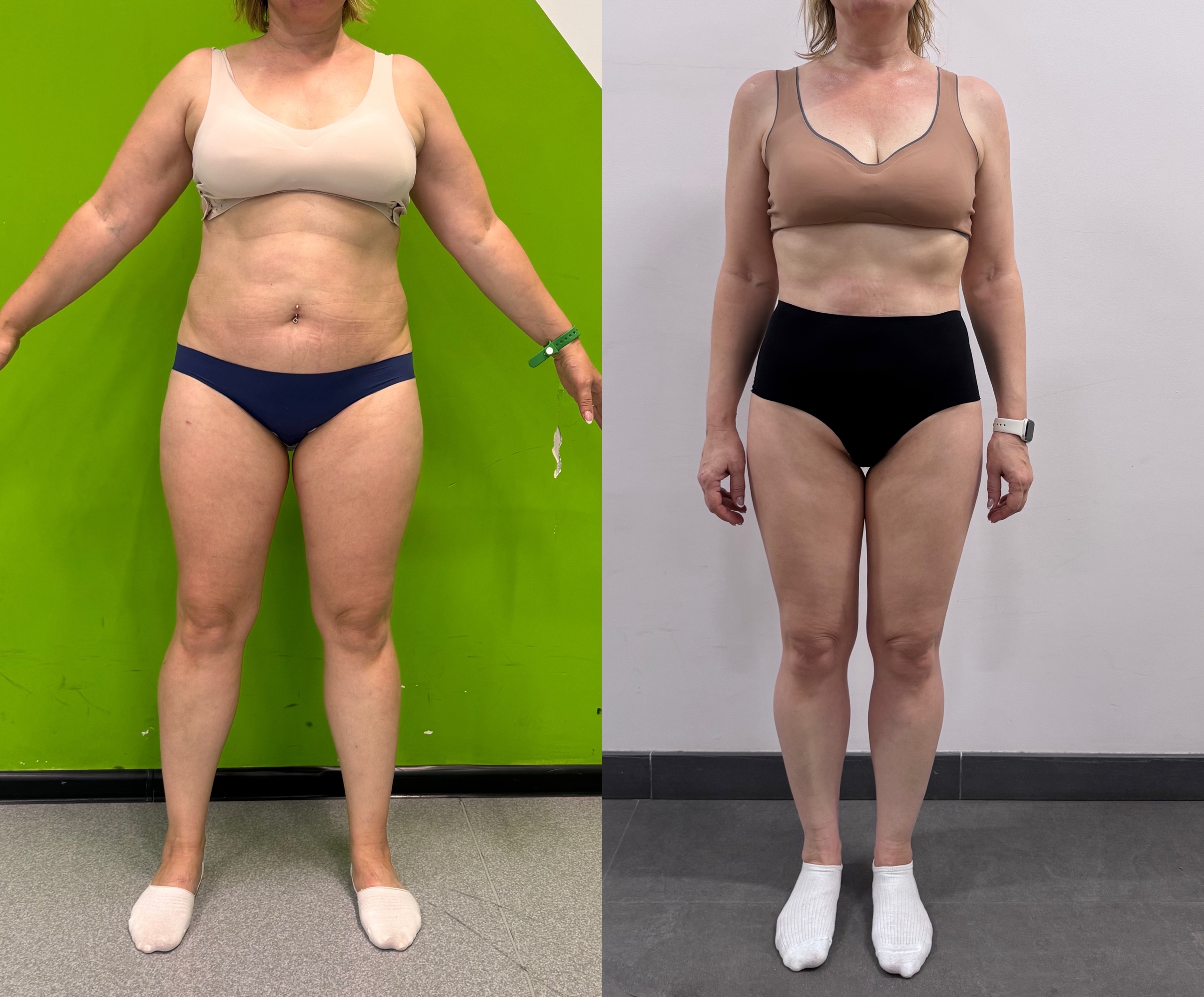 Результат участницы